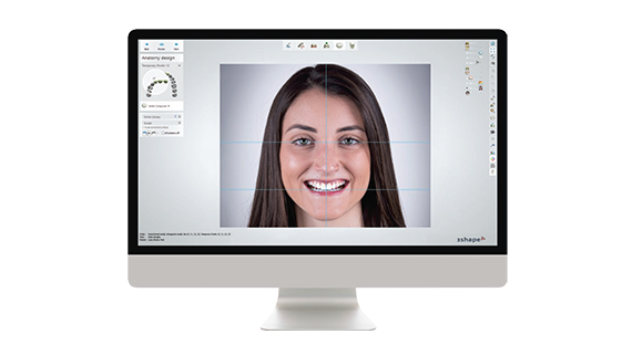 Smile design software – 2d3d